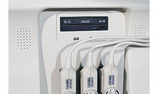 心脏彩超多少钱 心脏彩超多少钱